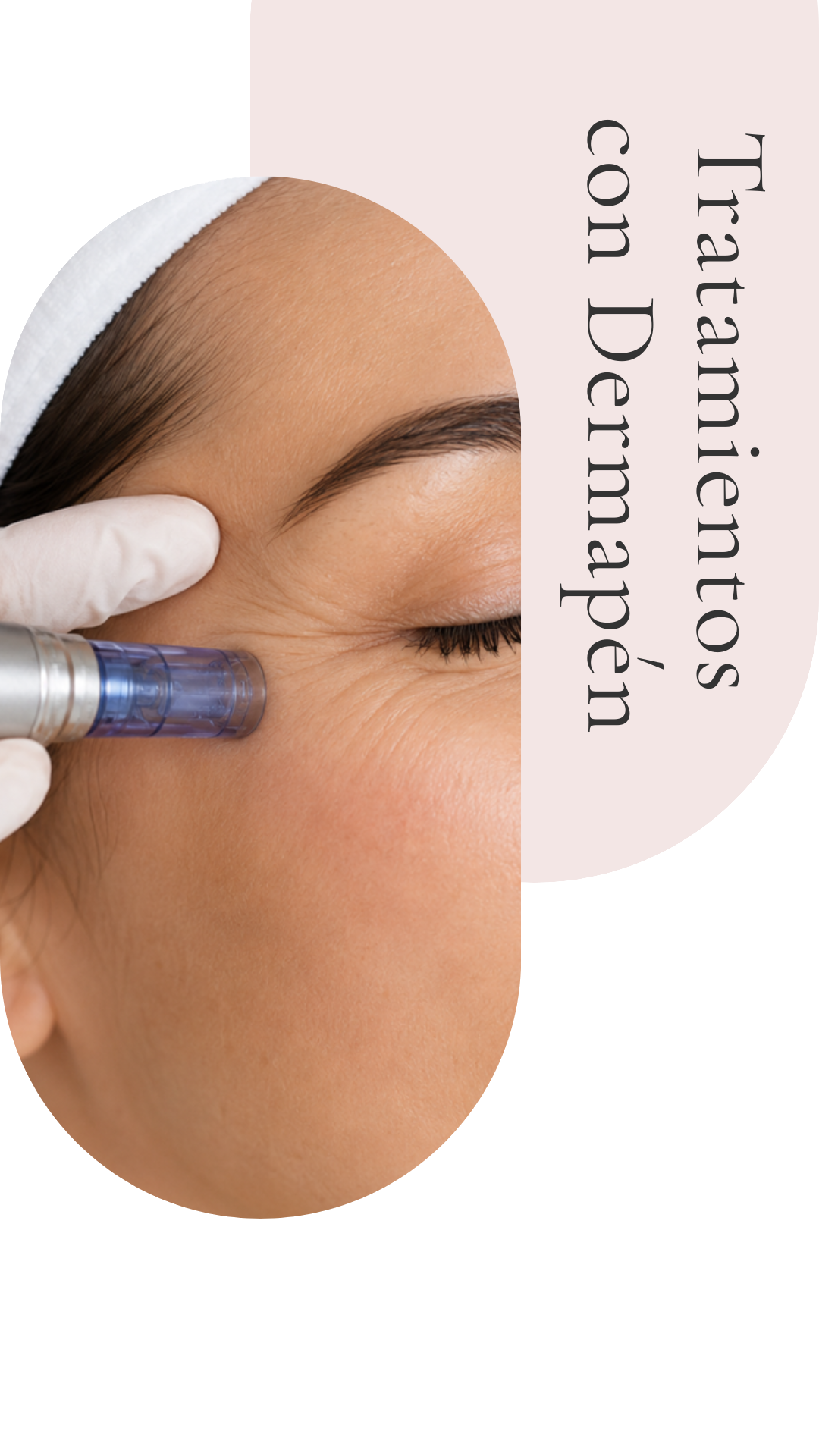 dermapen microneedling antiage