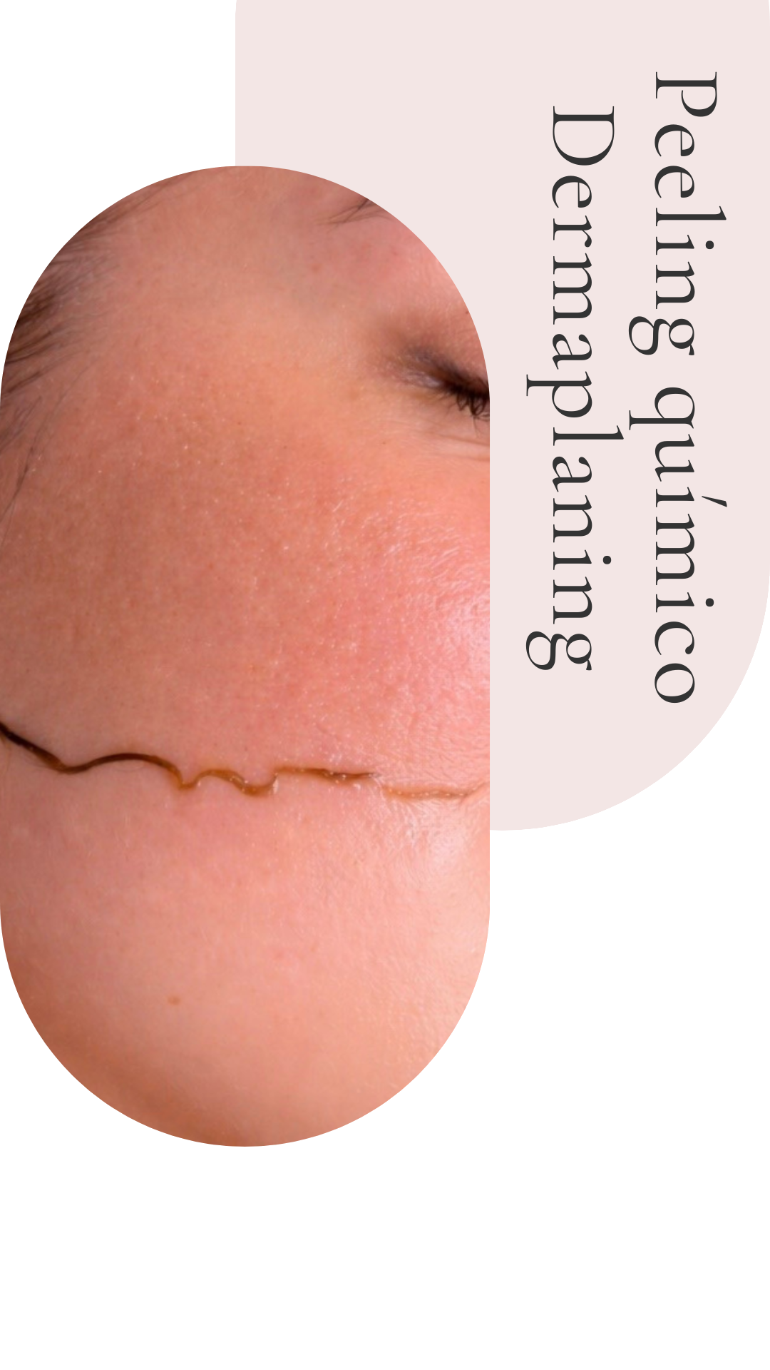 servicios de dermaplaning